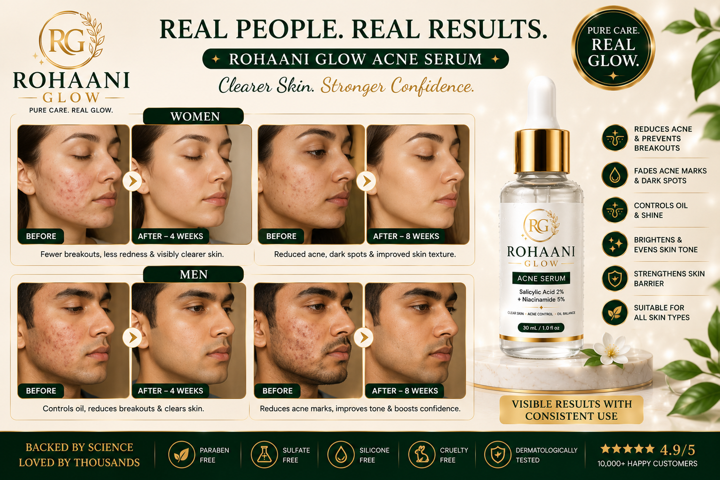 ✨ Rohaani Glow Advanced Acne Serum